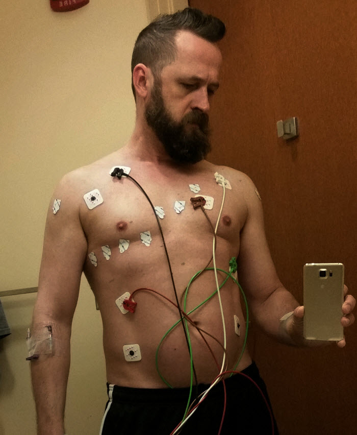 ekg_pads.jpg